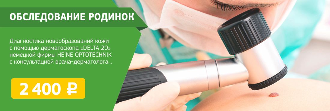 Проверить родинку на онкологию в красноярске по фото