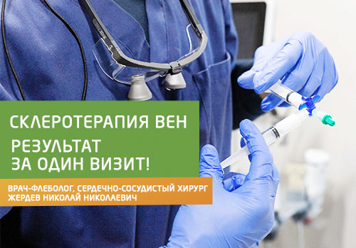Склеротерапия